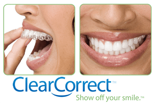 ClearCorrect  A lifetime of smiles starts today.